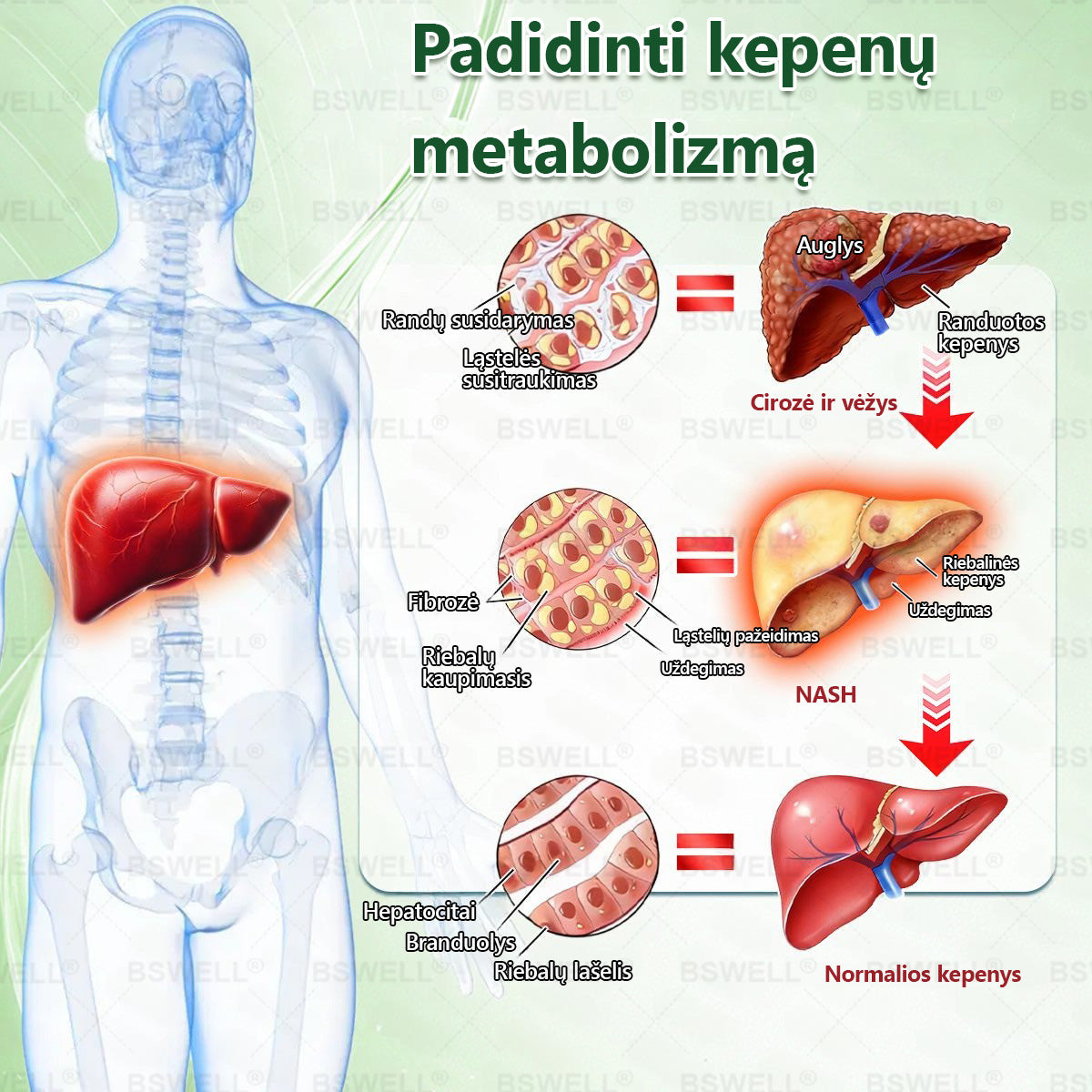 👩‍⚕️BSWELL® Nano mikroadatinis lieknėjimo pleistras – Matomi pokyčiai per 28 dienas Svorio kontrolei, širdies sveikatai, cukraus balansui, žarnynui ir sąnariams.